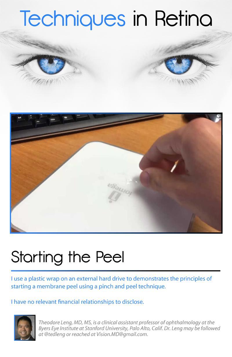 New Retina MD