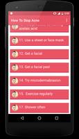 How To Stop Acne